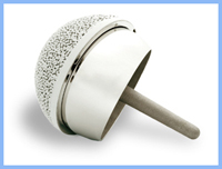 the birmingham hip resurfacing image1