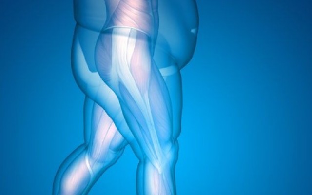 Obesity and Joint Replacement Surgery